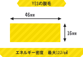 YESの脱毛